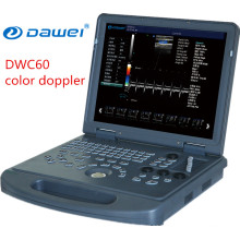 Equipo médico del precio de la máquina del ultrasonido de Doppler del color